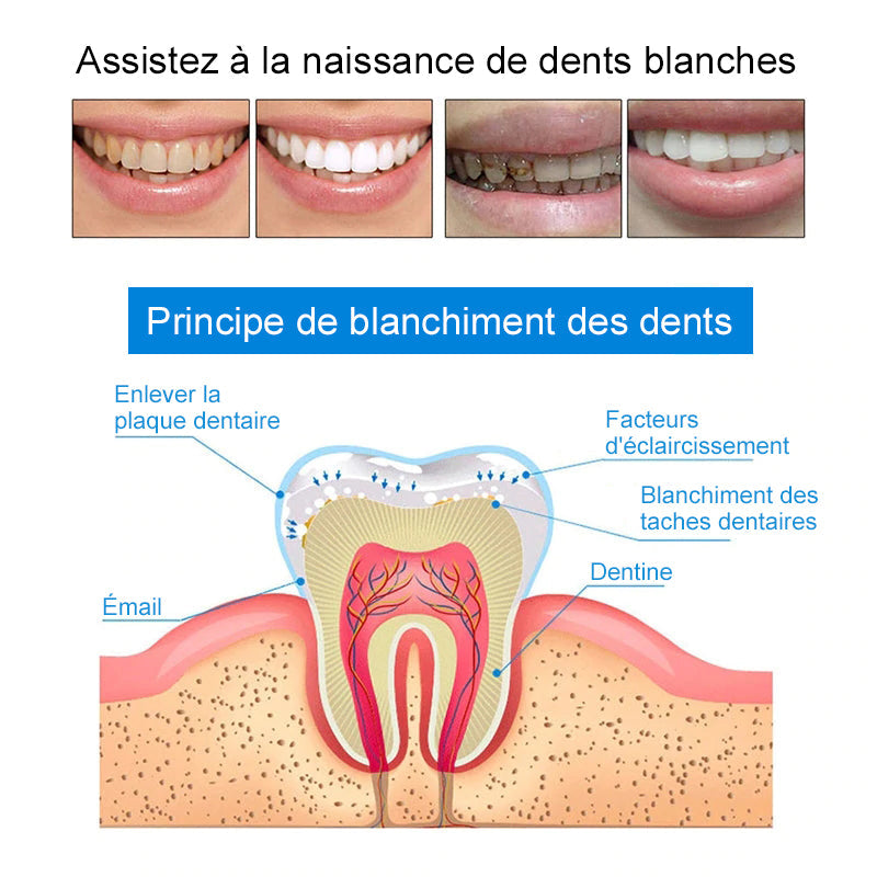 Stylo de nettoyage et de blanchiment des dents